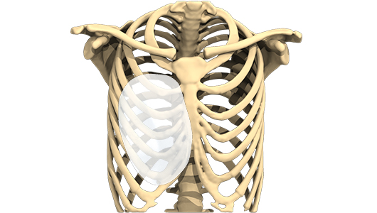 Vista 3D de un implante para tratar un tórax en embudo Vista 3D de un implante para tratar un tórax en embudo