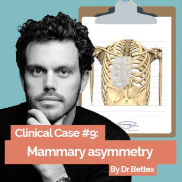Caso clínico de Pectus por el Dr Bettex