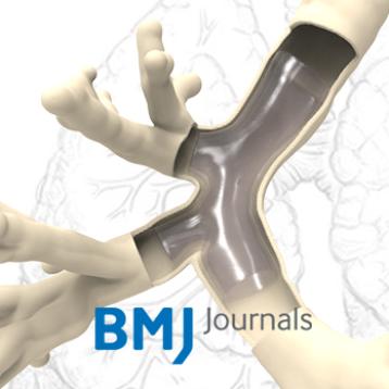 BMJ Journals publication: Double bifurcated airway stent BMJ Journals publication: Double bifurcated airway stent